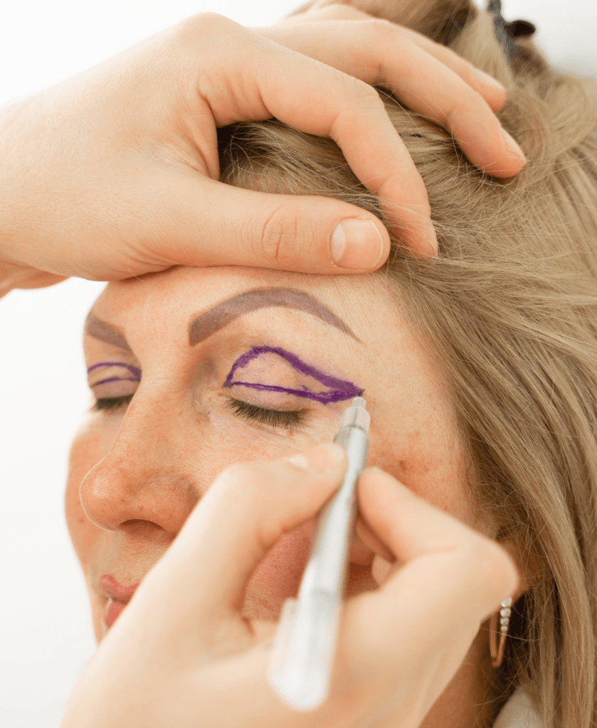 Eyelid surgery