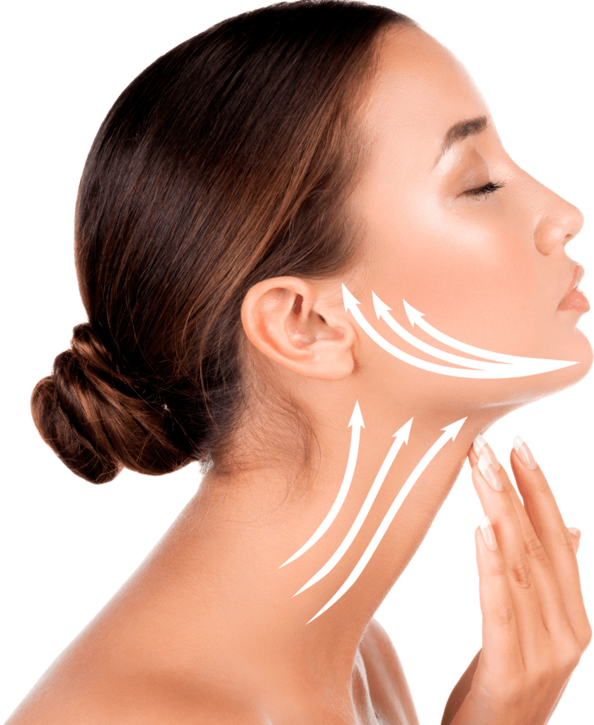 Neck Lift