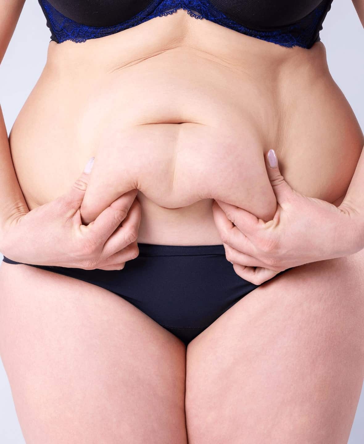 Tummy-Tuck-Surgery treatment process